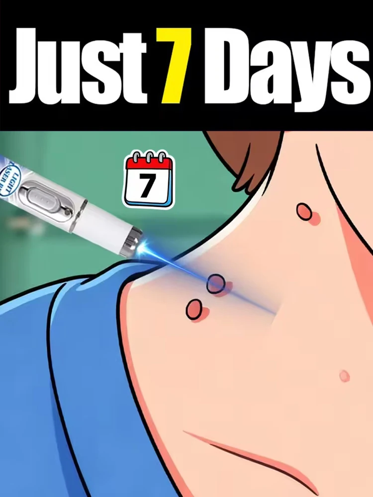 

Ручка для удаления синих пятен после того, как они высохли и отвалились.