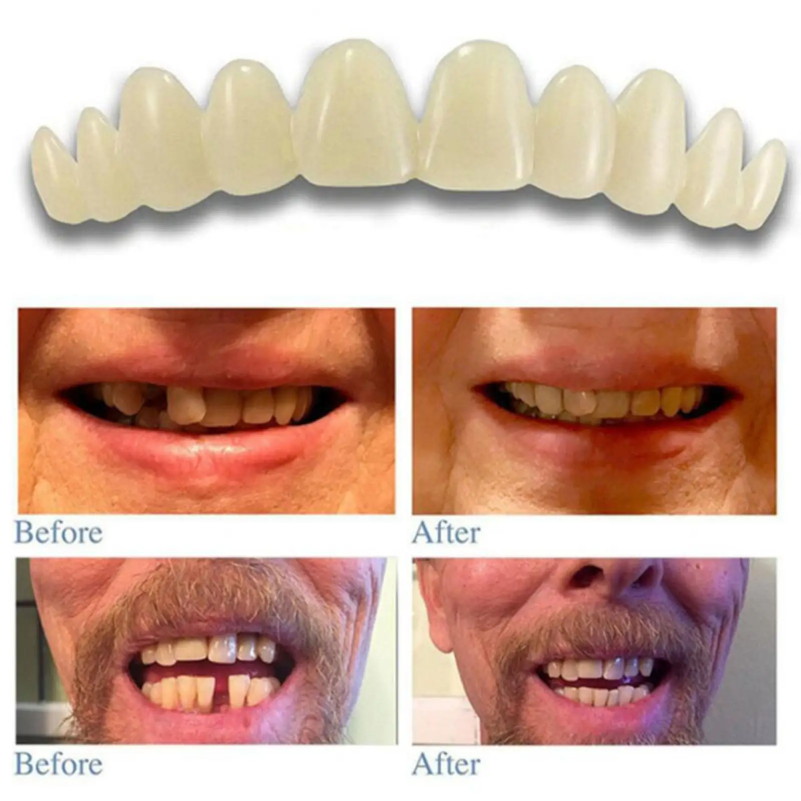 Temporary Tooth Replacement Kit Snap in Dental Veneers Soft Silicone for Broken Teeth Enamel Polish for Women