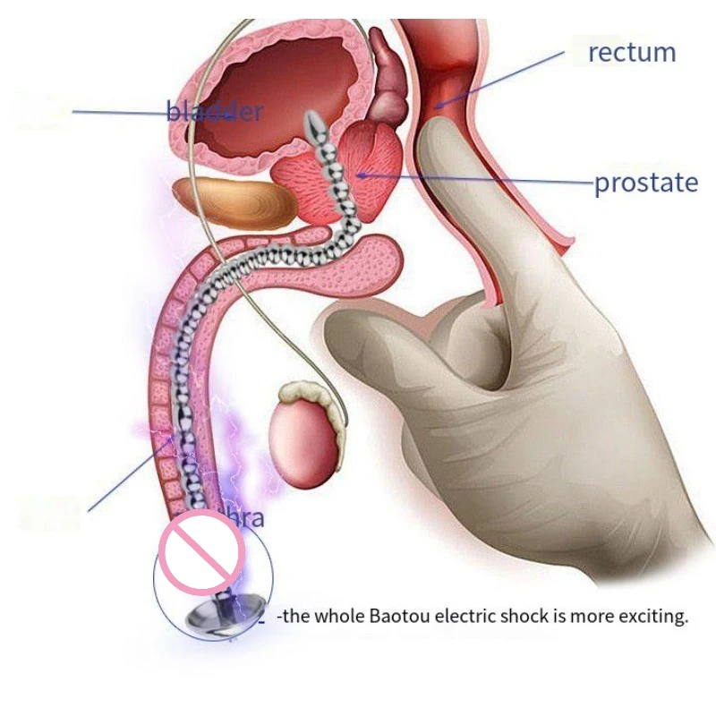 Expansión de ojo de caballo, bloqueo de la uretra, Sexo Jugete Se Xual, masturbador de pene Gay 18+, accesorios de Shoop Sexi, entrenamiento de pene Porno