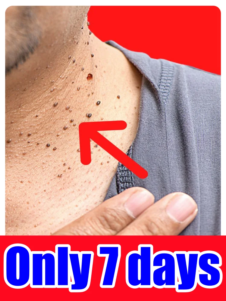 

2025 Portable Unisex Skin Cleansing Tool: Say Goodbye to Skin Problems