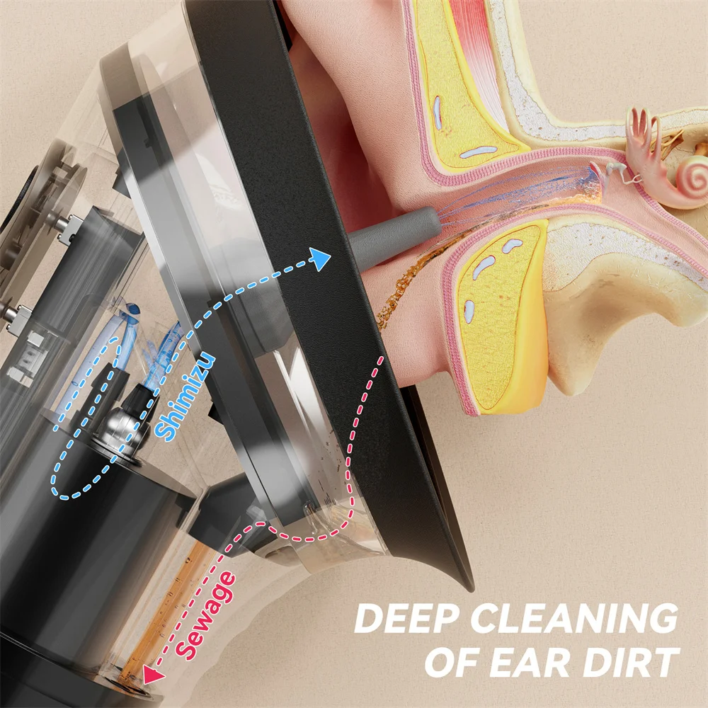 Upgraded Ear Wax Removal with One-Piece Waste Tank Safe Ear Cleaner with Water Temperature Sensor Waterproof Effective EarClean