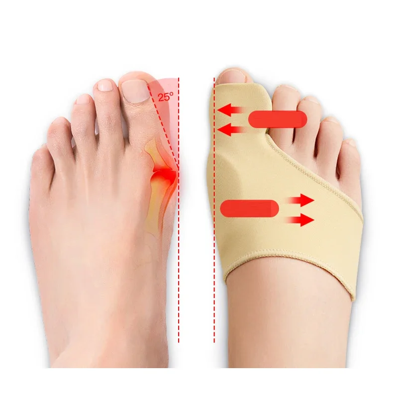 

Bunion Corrector Halux Valgus Corrector Bunions Corrector Women Toe Separator Foot Finger Separators Hallux Valgus Corrector