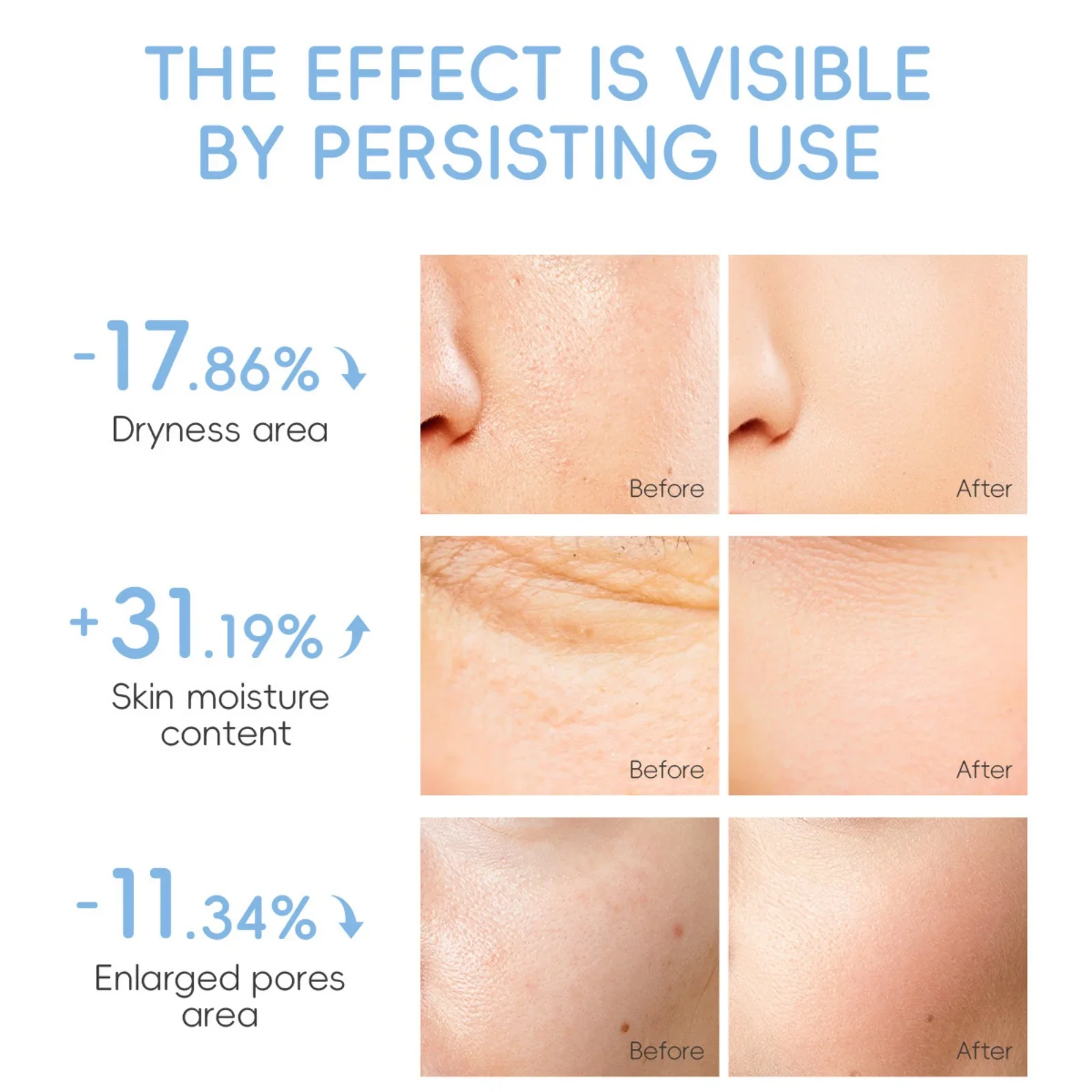 الحليب الكولاجين قناع الوجه 25 جرام ترطيب ترطيب اشراق تشديد المسام مكافحة الشيخوخة العناية بالبشرة الإسعافات الأولية علاج الوجه #4