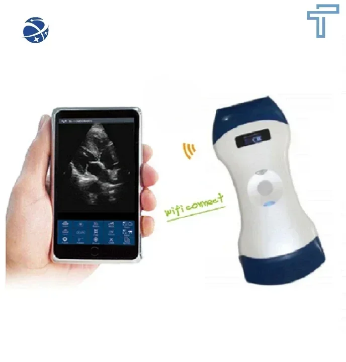 

Original brand newMT MED·ICAL 3 IN 1 color dop·pler 128 elements wireless ultrasound portable scanner machine price