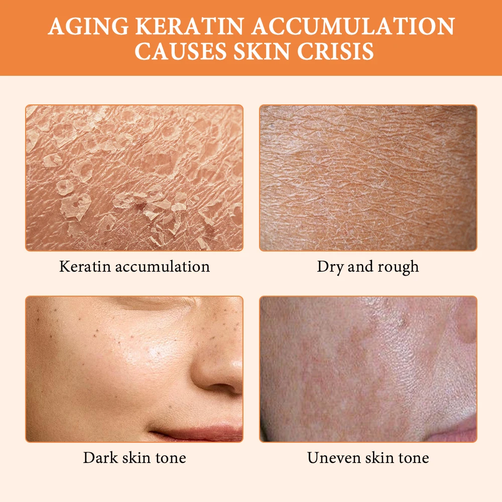 مقشر جل تقشير البرتقال لجلد الجسم التطهير العميق ترطيب مقشر الوجه تعزيز حاجز الجلد مقشر الوجه الطبيعي