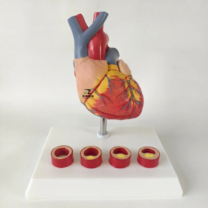 

Large natural heart zone thrombosis medical teaching and training model