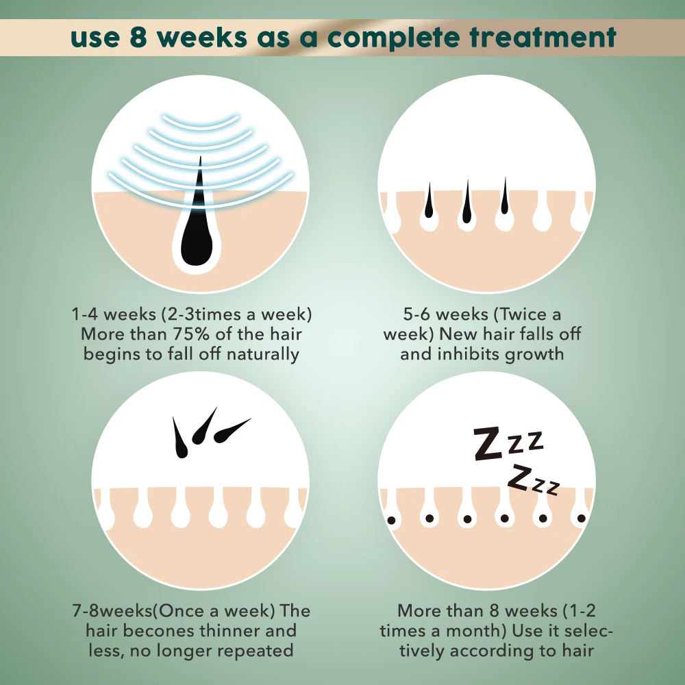 جهاز إزالة الشعر بالليزر المحمول من Sejoy IPL للنساء والرجال مع شاشة LCD للحماية من الحرارة الزائدة NTC