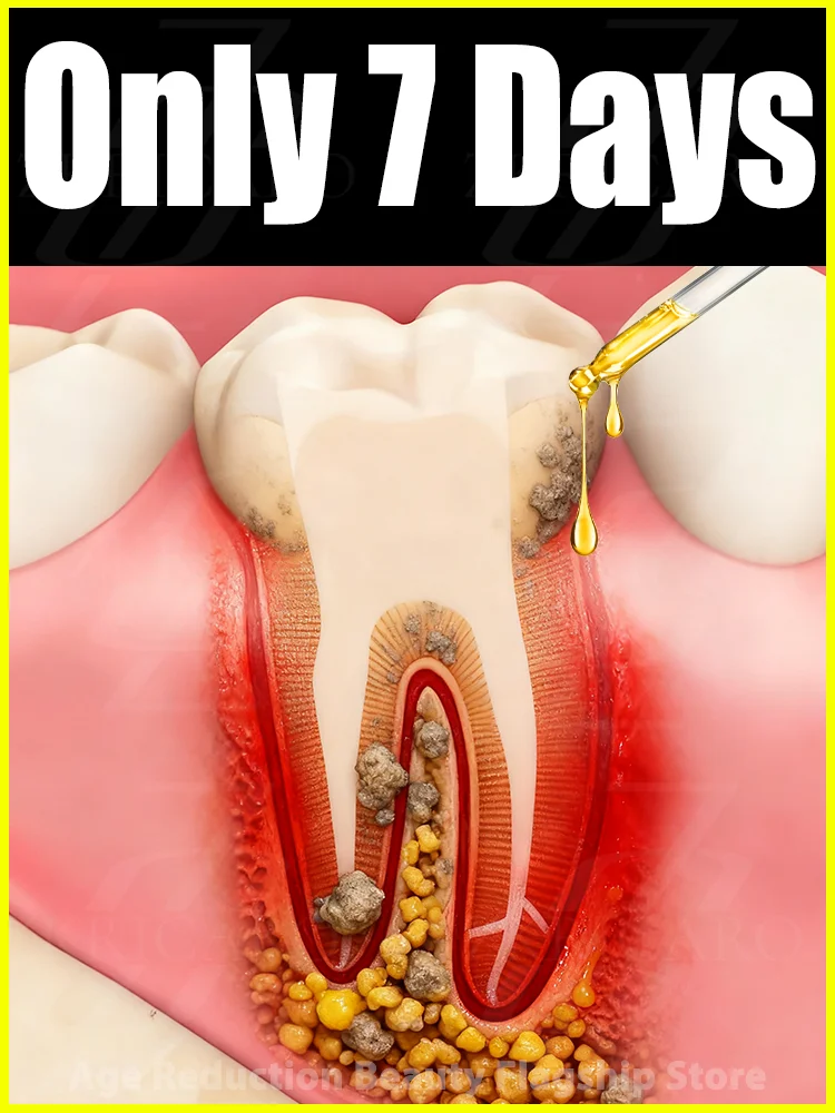 Eᴀsɪʟʏ ʀᴇɢᴇɴᴇʀᴀᴛᴇ ɢᴜᴍs ᴀɴᴅ ᴄᴏᴠᴇʀ ᴛᴇᴇᴛʜ ɪɴ 7 ᴅᴀʏs
