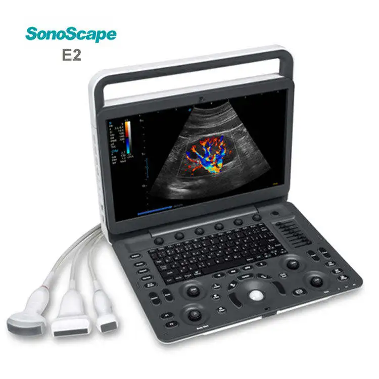 Ultrasound for Vet and Human Portable Smart Electric Ultrasound Device medical supplies and equipment