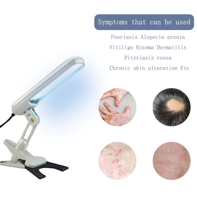 UVB Phototherapy Narrow 311nm UV Phototherapy Lamp Uvb Light Therapy Psoriasis For Vitiligo