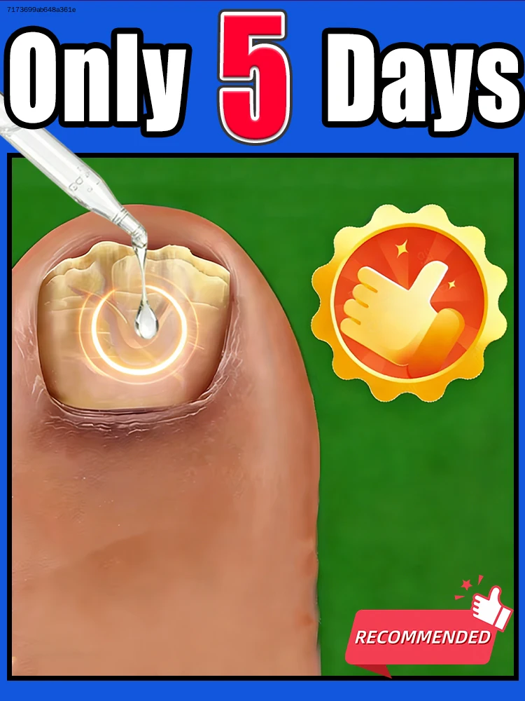 

Dɪᴛᴄʜ ᴄʜᴀᴘᴘᴇᴅ ᴄᴜᴛɪᴄʟᴇs, ᴋᴇᴇᴘ ғɪɴɢᴇʀᴛɪᴘs ɴᴏᴜʀɪsʜᴇᴅ ᴀɴᴅ ʜʏᴅʀᴀᴛᴇᴅ