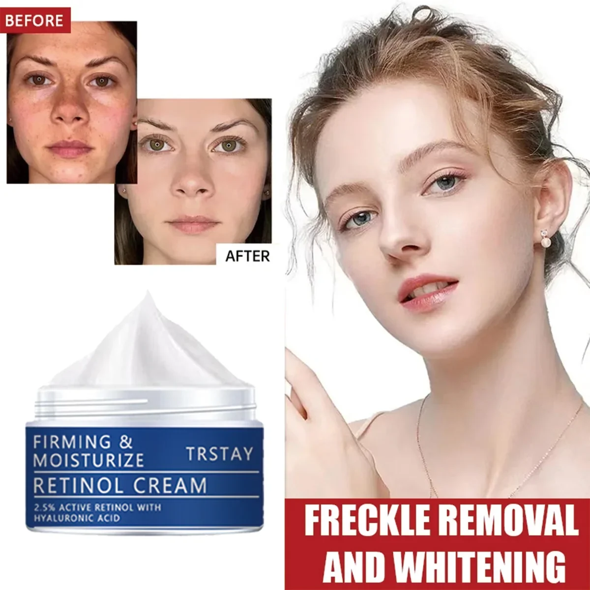 كريم وجه TRSTAY Retinol 2.5% لشد وترطيب نشط مع حمض الهيالورونيك وتبييض البشرة للعناية بالأمومة #2