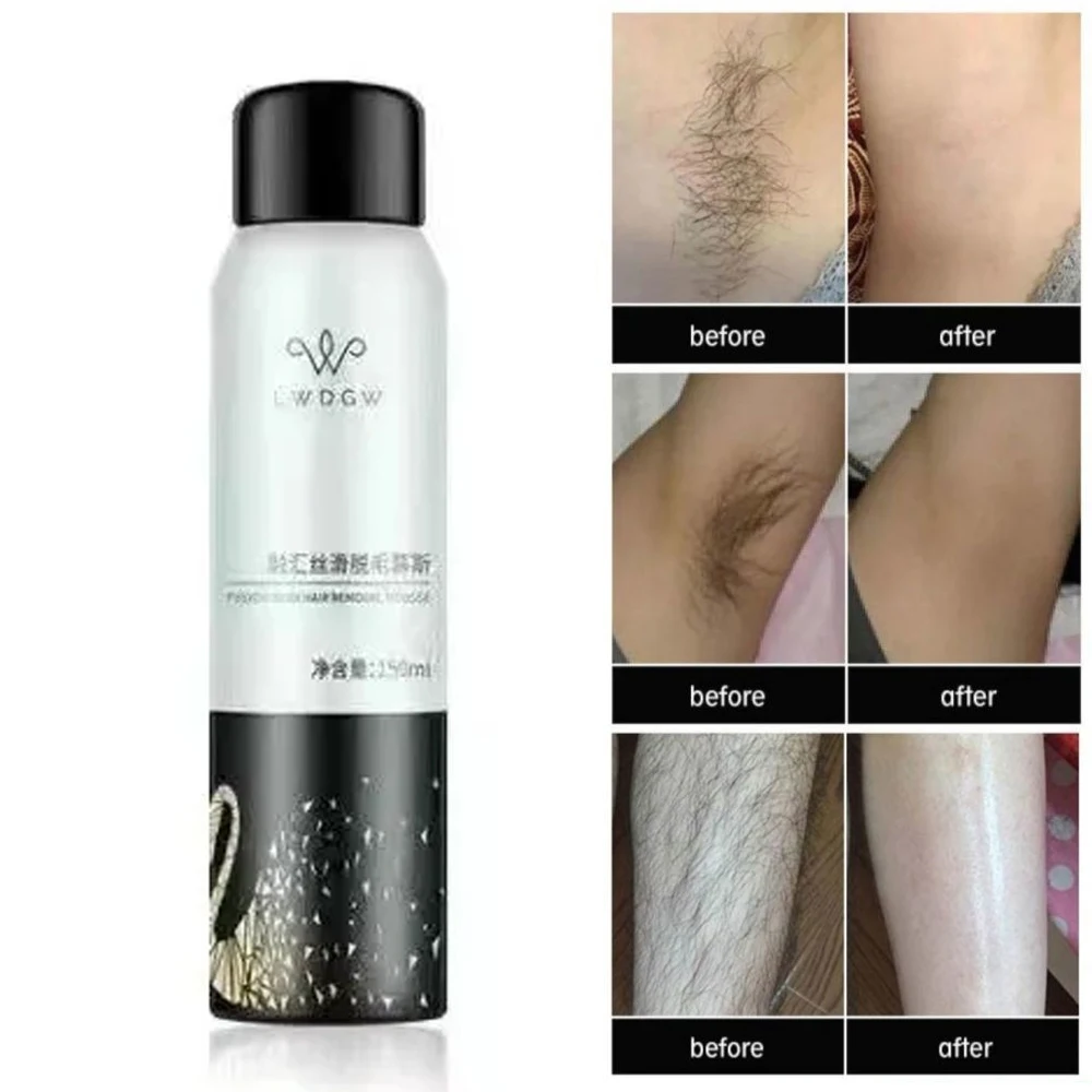 Painless Hair Removal Mousse Mild Non Irritating Hair Removal Legs, Armpits, Lips, Moist Repairing Skin Men Women 150ml