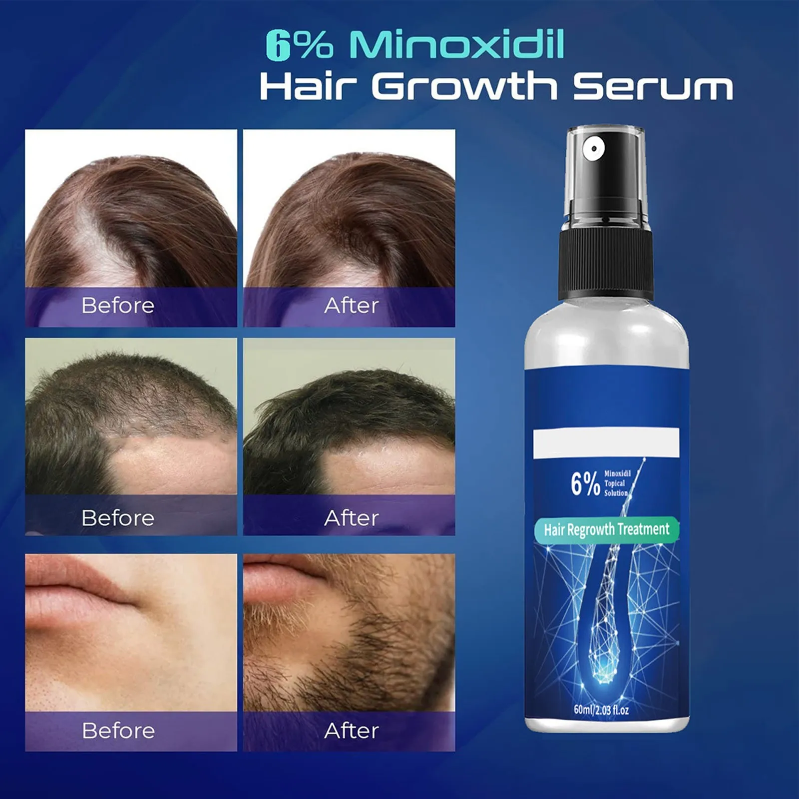 Topical Solution Hair Growth Spray For Men And Women Hair Regrowth Serum For Thicker Longer Hair Help To Stop Thinning