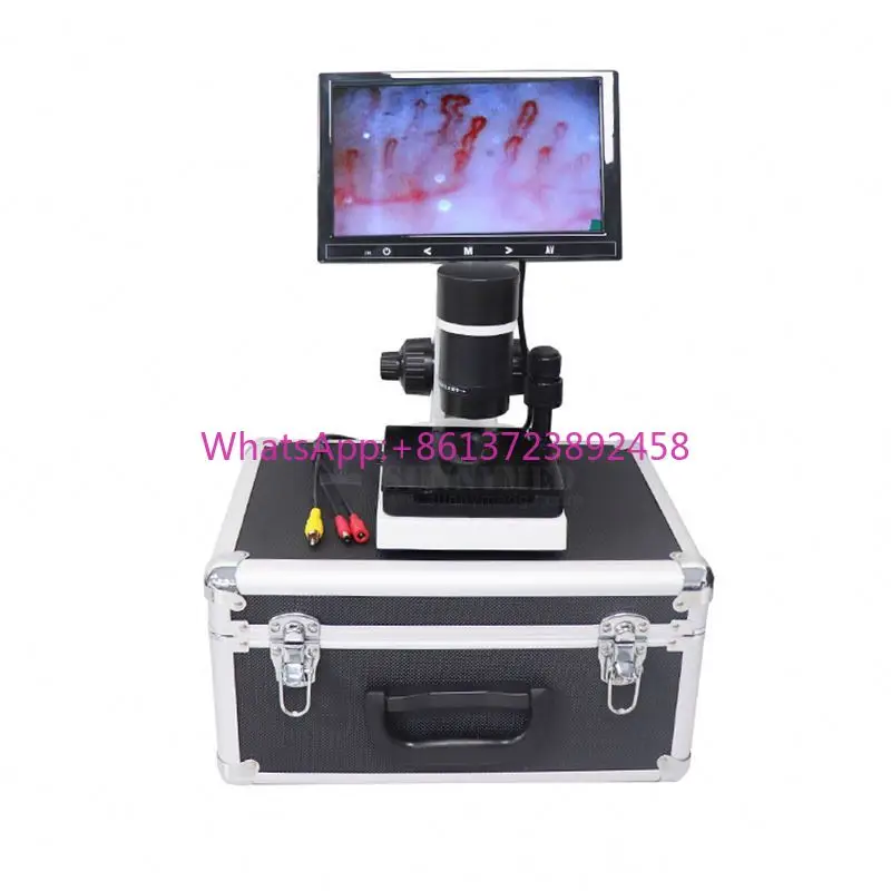 SY-B198 Capillary Microscope With 9 Inch LCD Screen Nail Fold Capillaroscope