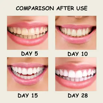 10 best sales キシリトール - №6