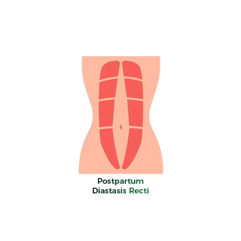 Orthotics Therapeutic Radial Shockwave Therapy Device Postpartum Diastasis Recti Treatment