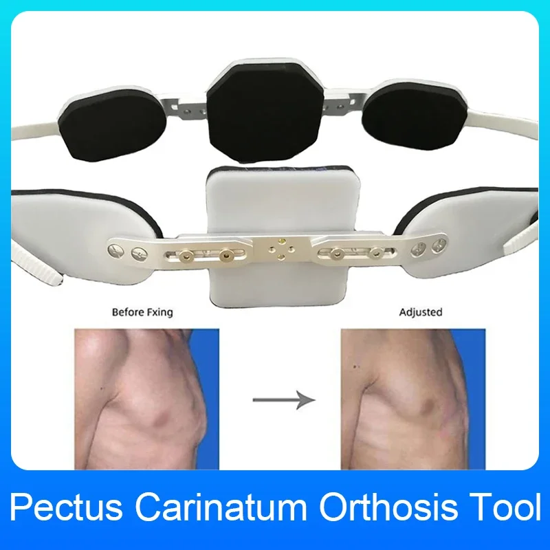 Adjustable Pectus Carinatum Orthosis Brace Pigeon Chest Orthosis Support Ribs Valgus Orthosis Braces Kids Adults Universal