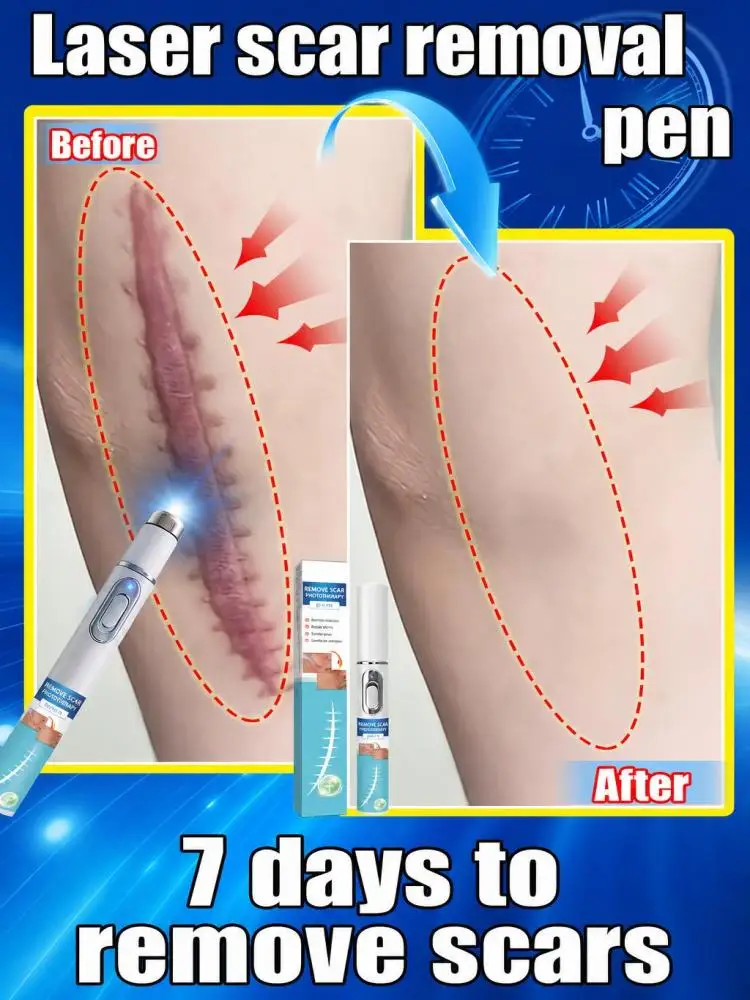 Compact Skin Surface Beauty Instrument Hand‑Operated Personal Skin Care Device Improve The Look Of Uneven Rough Tight Skin Marks Lightweight Tool For Household Beauty Routine