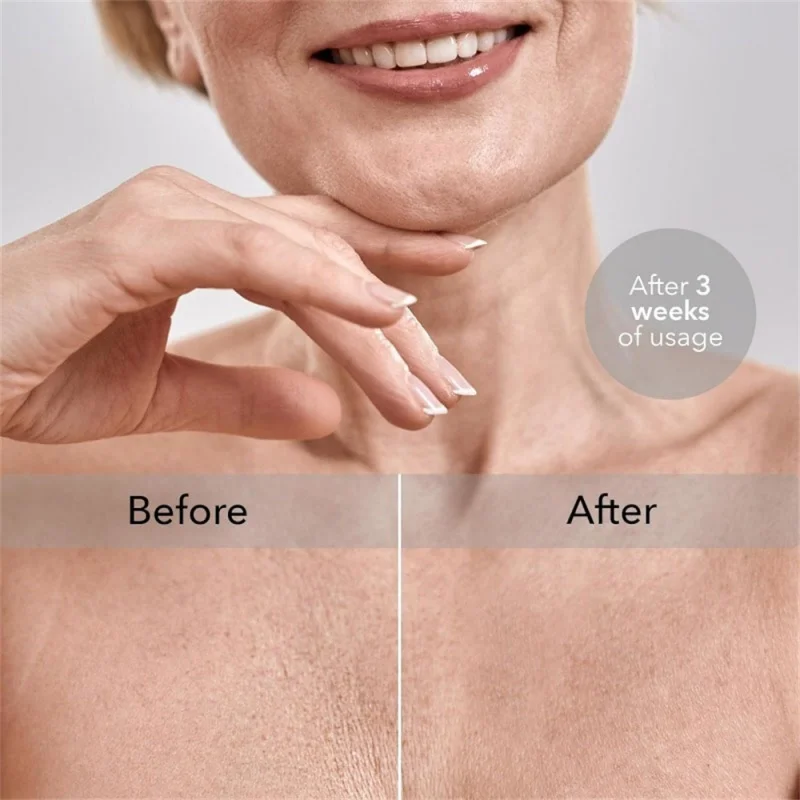 Side Sleeping Chest Anti-wrinkle Pillow Breast Support Protective Gear Soft Breathable Pads Fade Chest Lines Removable Washable