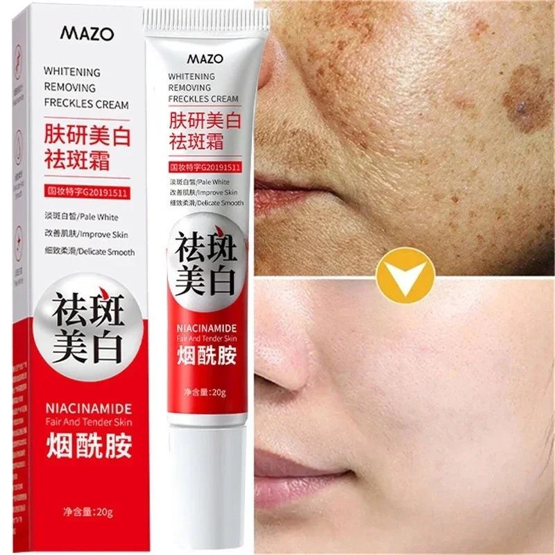

New Powerful Spot-Removing Whiten Cream Brighten Skin Fast Eliminates Melanin Pigmentation Melasma Dark Spots Korean Skin Care