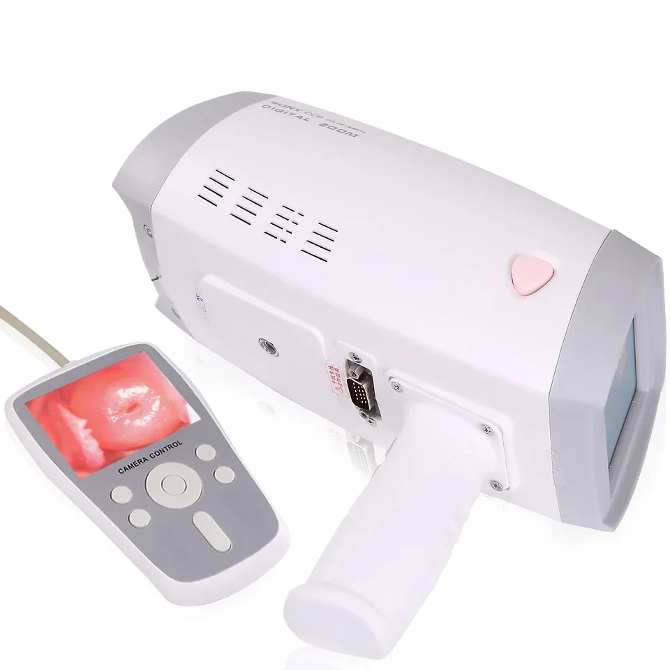 For HKN-2000 Handheld Digital Video Colposcope for Gynecology