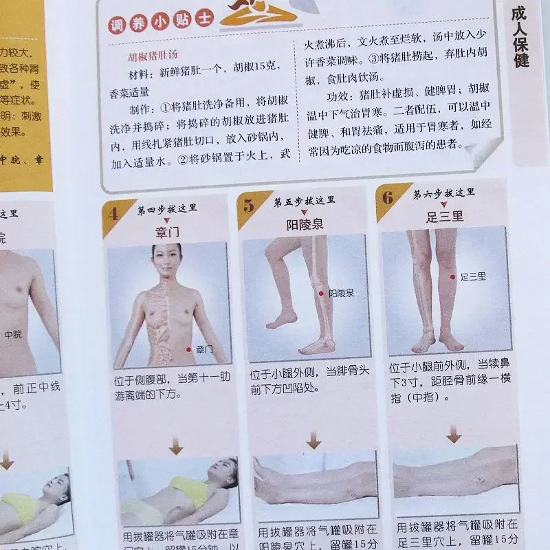 Schröpfen Gesundheit Körper Entfernung Buch Illustrierte TCM Akupunkturpunkt Null-basierte Schröpfen Einführung Schröpfen Technik Tutorial