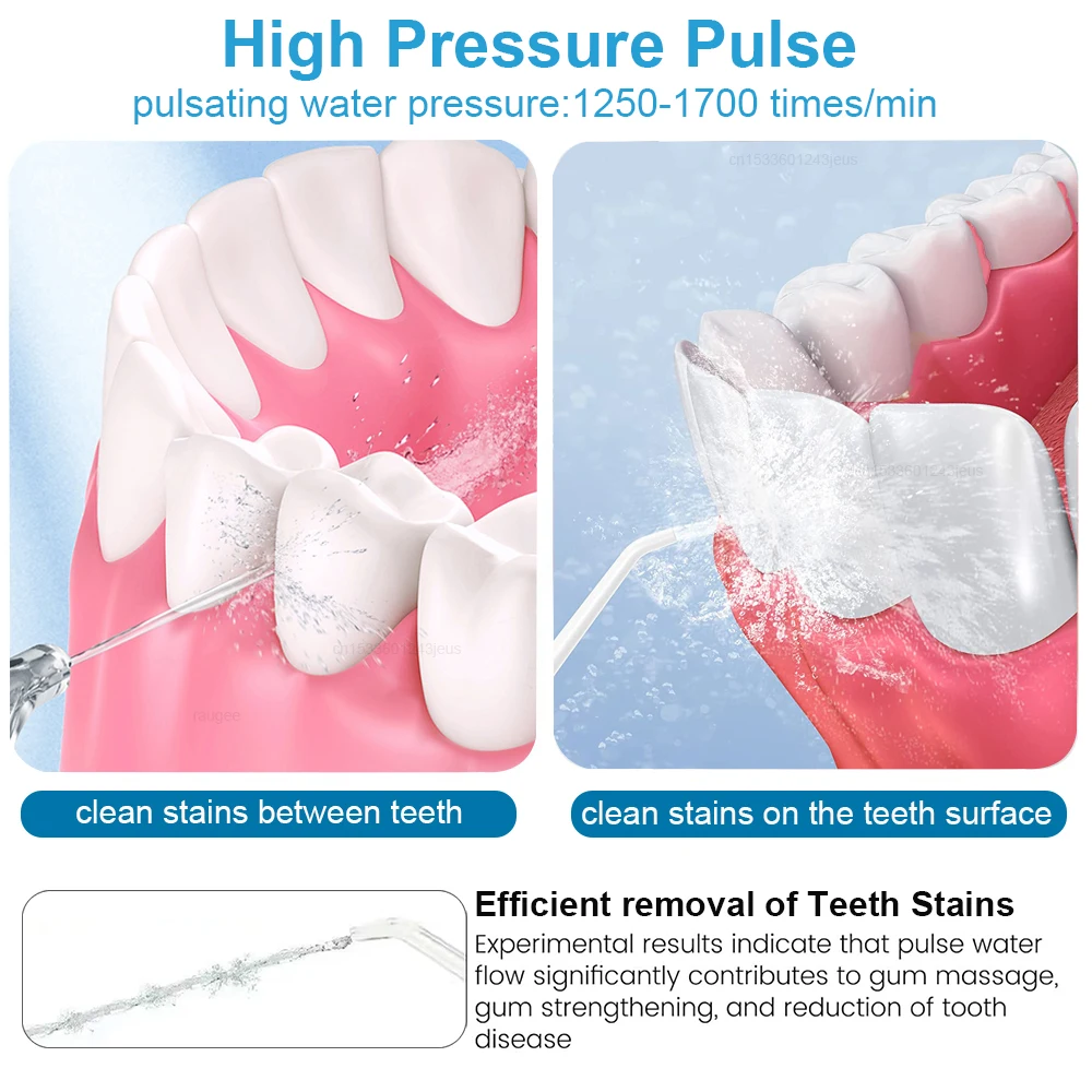 Thumbnail 4 - #11 Top Rated Water Flossers to Buy in 2026