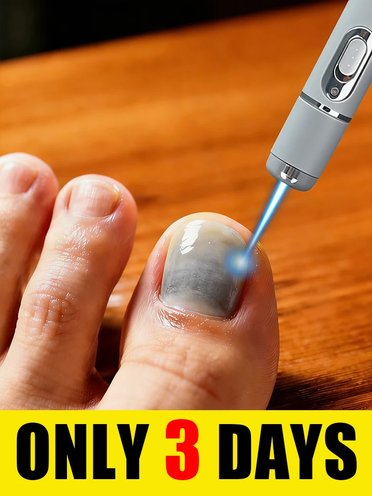 

Самая популярная лазерная ручка с синим светом для ног 2026 года — мягкая, не вызывающая раздражения, и удобная в использовании для домашнего применения.