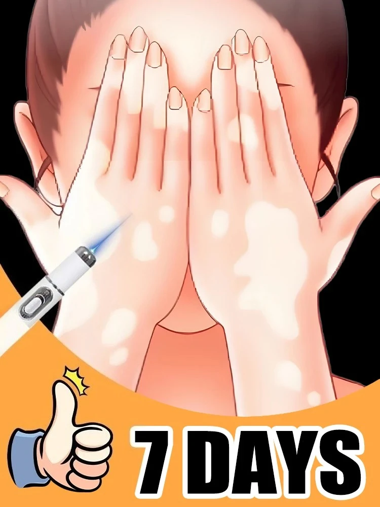 

Генерация - 2 лазера «Прощайтесь к витилиго» в течение 7 дней