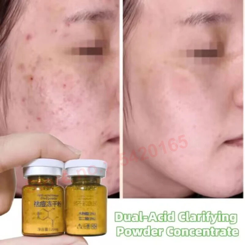 High Quality Salicylic Acid Facial Peel Remover Brighten Peeling Unlock Profound Exfoliation Whiten Hydrating Freeze-Dried Powde