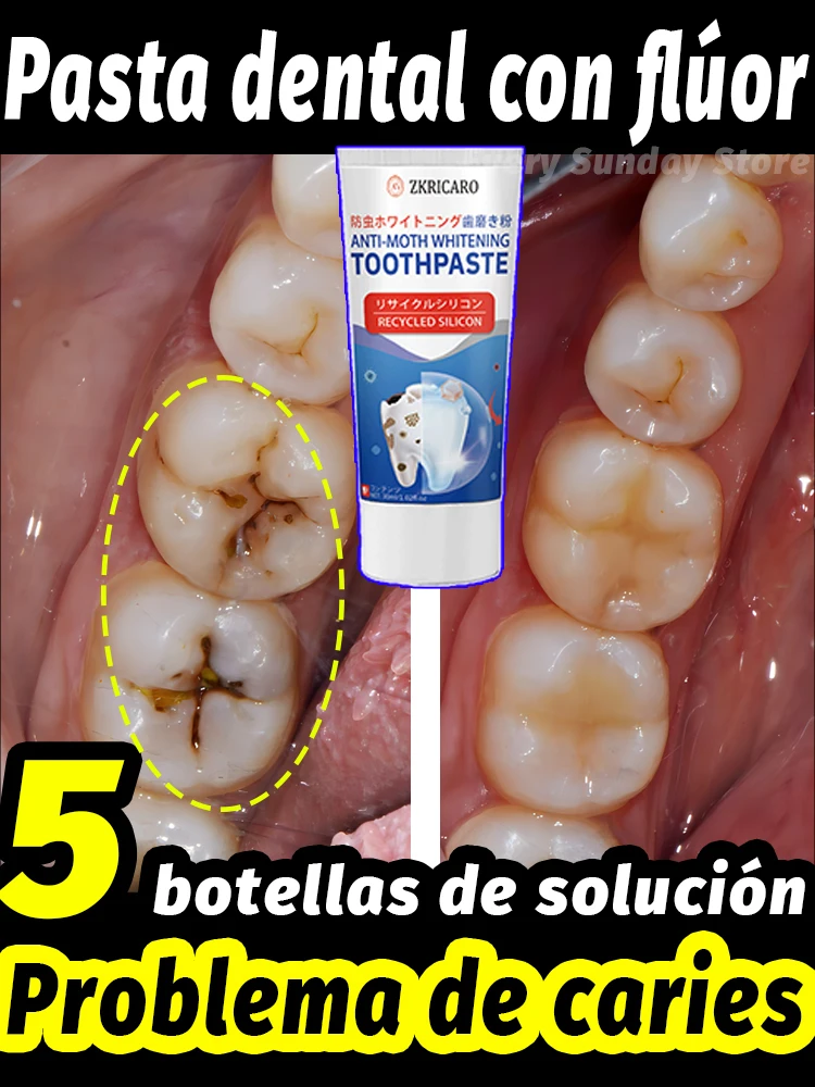 Decaimiento dental