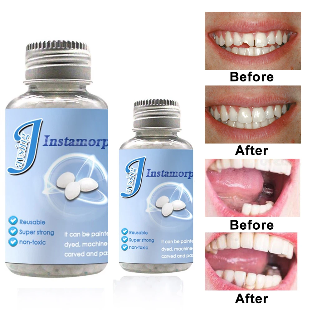 False Teeth Solid Glue Denture Solid Tooth Gel Temporary Tooth Filling Material Tooth Replacement Material Tooth Repair Kit