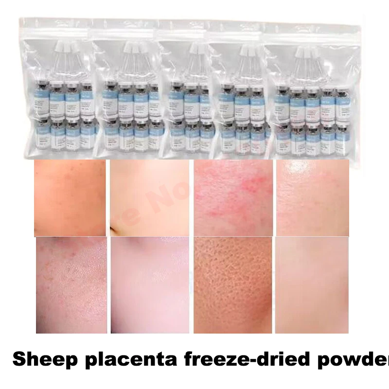 

Facial Sheep Placenta Essence Anti-Acne Anti-Wrinkle Lock Water Restore Skin Aging Relaxation Freeze-Dried Powder Skin Care