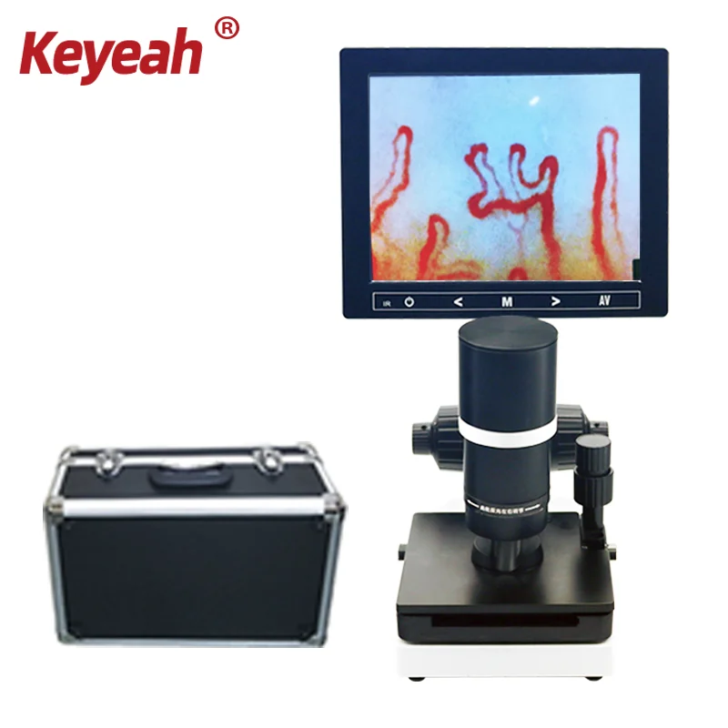 HD microscope magnifying nail fold capillary microcirculation detector to observe blood vessel velocity, quantity and size