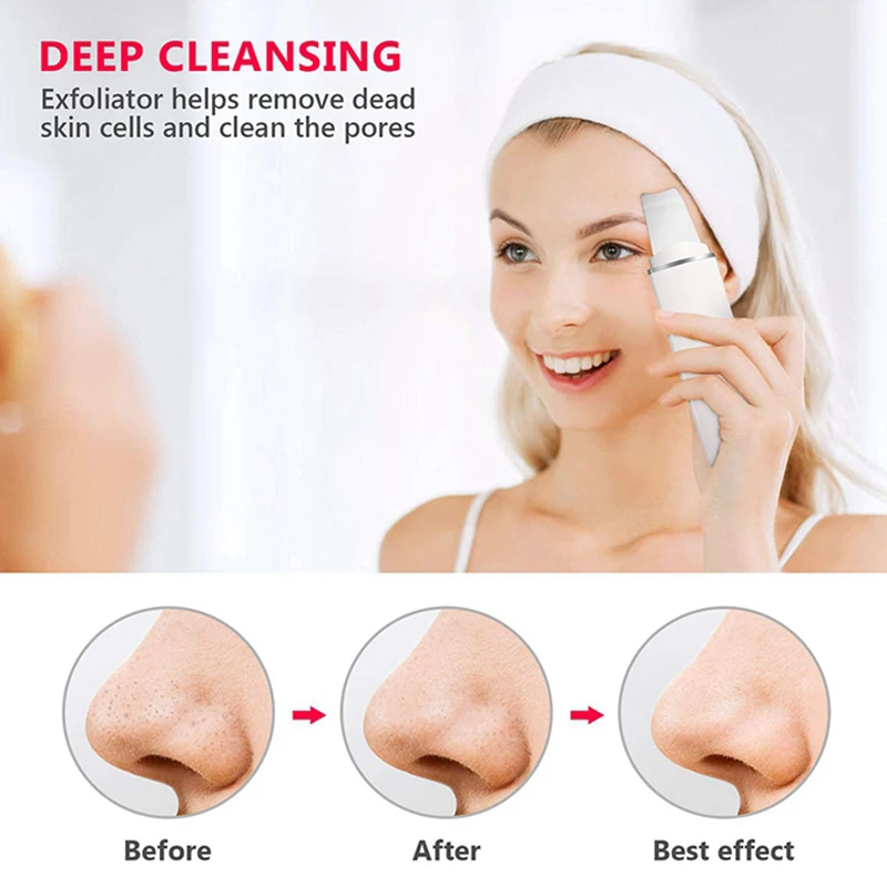 يهتز الجلد الغسيل تقشير مزيل الرؤوس السوداء تنظيف الوجه العميق بالموجات فوق الصوتية أيون حب الشباب المسام الأنظف مجرفة الوجه المطهر #2
