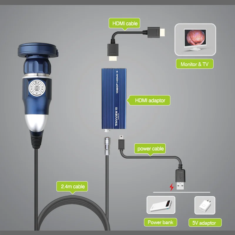 Advanced Protable Medical HD 1080P Endoscopy Camera for Surgery and Teaching