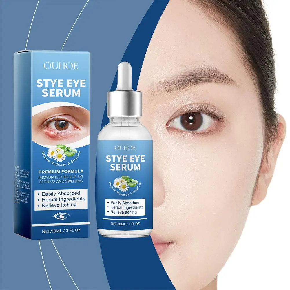 30ml Eye Swelling Relief Essence Relieves Eye Redness Swelling Stye Anti Fatigue Dry Itchy Around The Eyes Moisturizing Serum