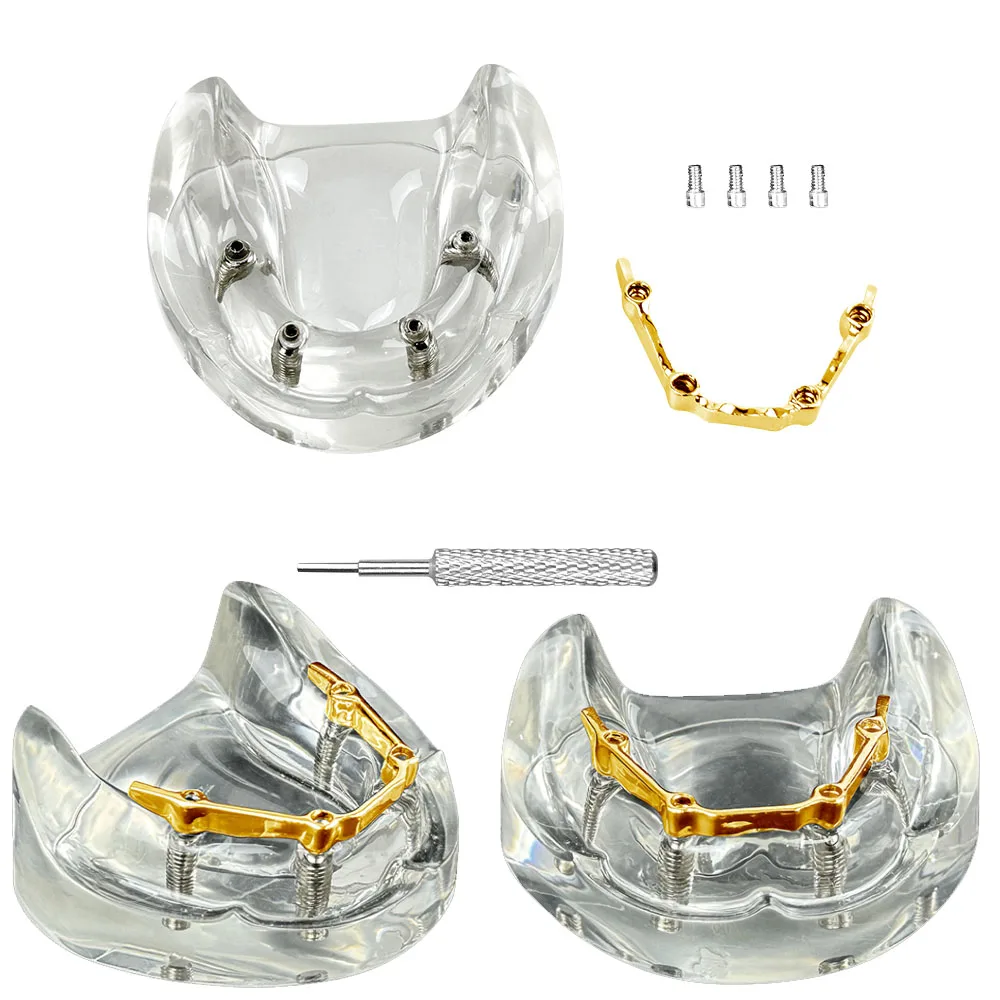 1Pcs Dental Implant… - image