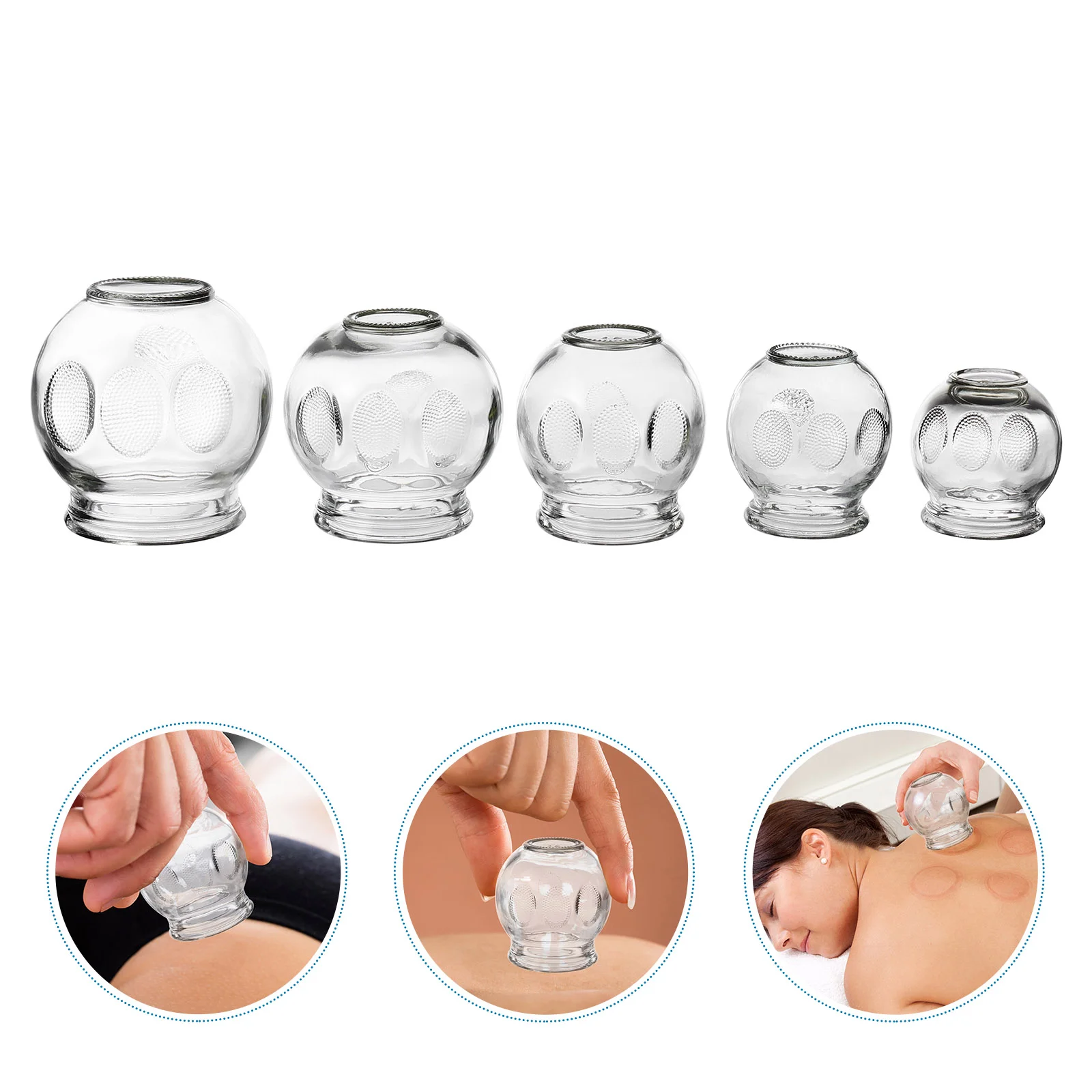 5-teiliges Glas-Schröpf-Therapiegerät, Schröpfbecher, Massage-Schröpfen, Vakuum-Schröpfen, chinesisches Schröpf-Set