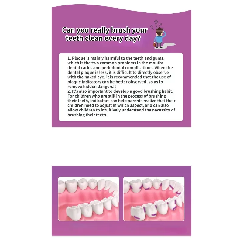 Indicatore di placca dentale Agente di divulgazione Macchia di tartaro Prova Esame Display dentale Liquido Proteggi la salute dei denti Igiene orale