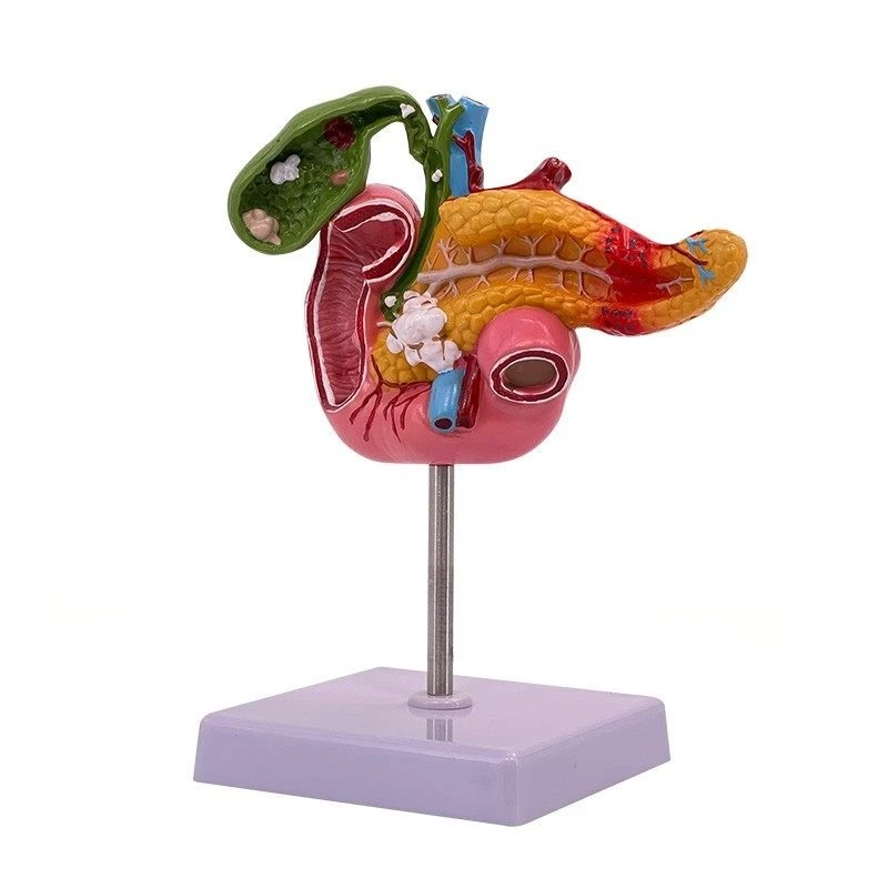 

Pancreatic duodenal gallbladder pathological model