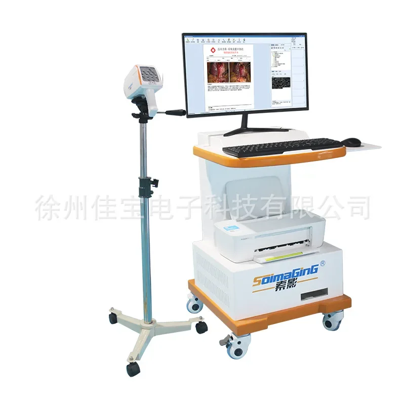 Full HD digital electronic colposcopy gynecological examination Manufacturer of HD 3.7 megapixel self inspection mirror