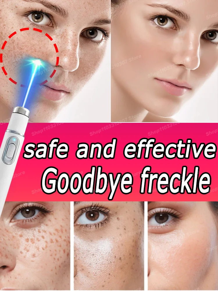 

Repair of Facial Dark spots