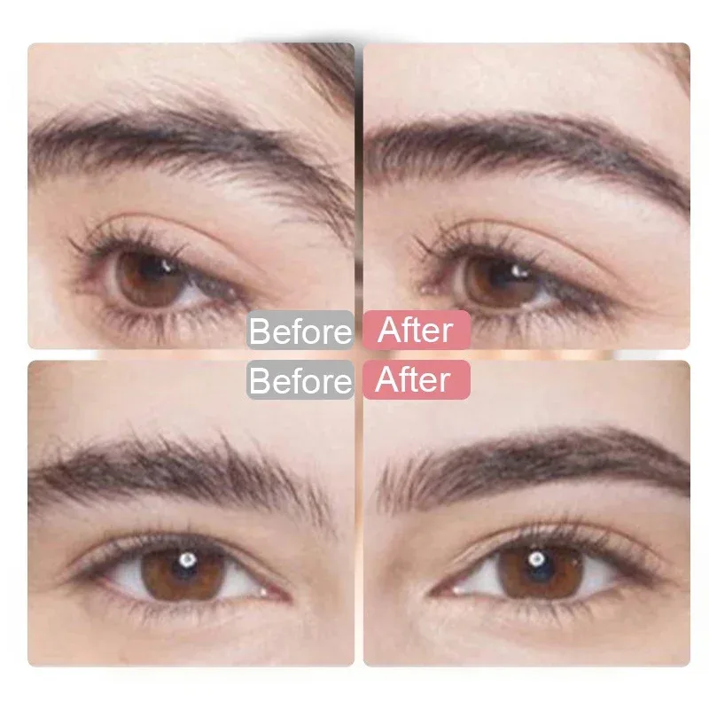 Thumbnail 2 - #59 Best Shaving & Grooming to Buy In 2026