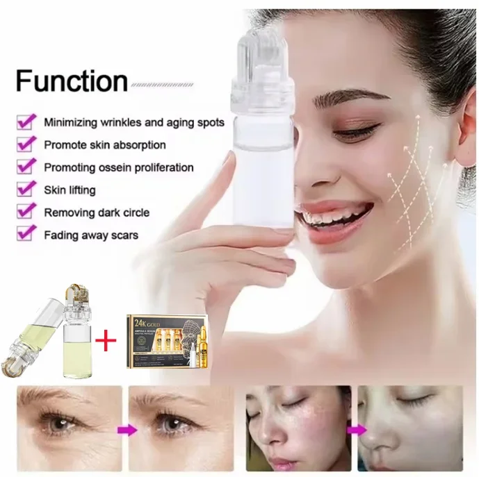 Microaguja de agua desmontable con rodillo de 64 agujas, adecuada para esencia facial de vitamina C de ácido hialurónico de oro de 24 quilates