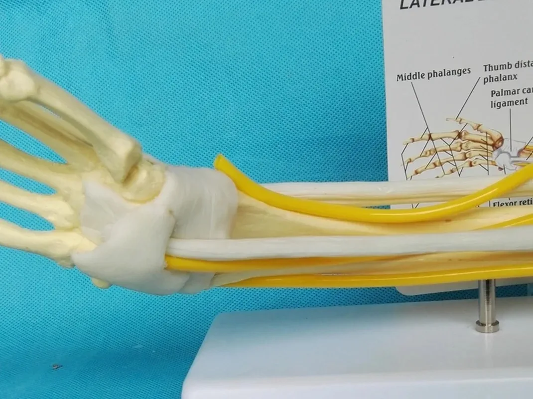 1:1 มนุษย์ขวาข้อศอกผู้ใหญ่แขน Upper Limb กล้ามเนื้อกระดูกมือกายวิภาควิทยาศาสตร์การแพทย์โรงเรียนอุปกรณ์การสอน Anatomy Skeleton