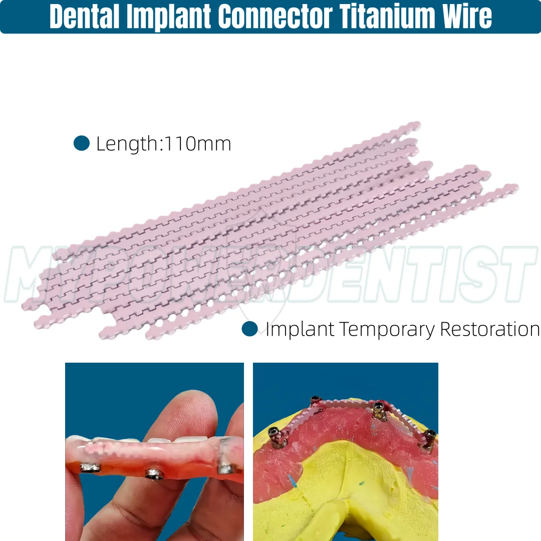 

Dental Implant Titanium Wire Denture Temporary Restoration Transfer Rod Fixed Pink Reinforcement 110mm