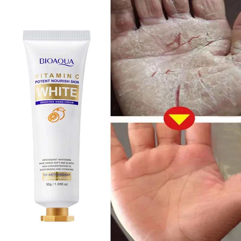 Remoção de rugas Anti-Crack Hand Cream, Hidratar, Esfoliante, Reparação, Anti-Envelhecimento, Nourish, Anti-Secagem, Whiten, Hand Care