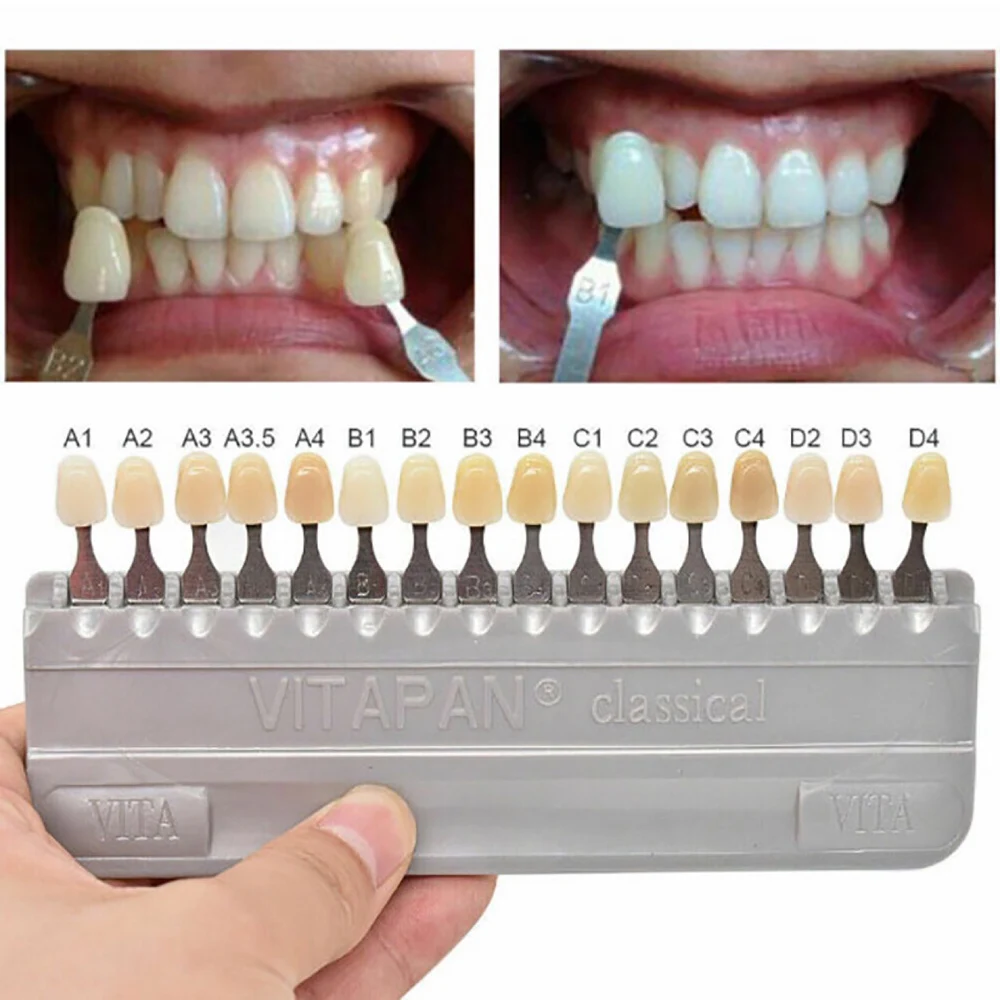 Denspay-Equipo Dental de porcelana para blanquear los dientes, modelo de placa colorimétrica VITA, guía clásica de 16 colores